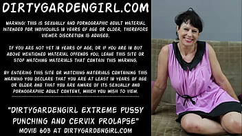 Dirtygardengirl extreme pussy and cervix prolapse
